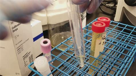 Urinalysis Preparing The 3 Patient Urine Specimens For Microscopic