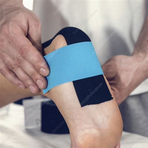 Kinesio Tape Application Stock Image F024 5353 Science Photo Library