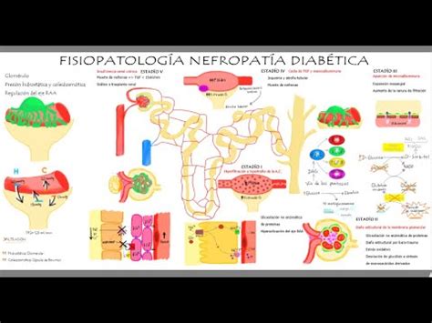 Fisiopatolog A De Nefropat A Diab Tica Youtube