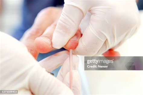 Blood Finger Stick Photos and Premium High Res Pictures - Getty Images