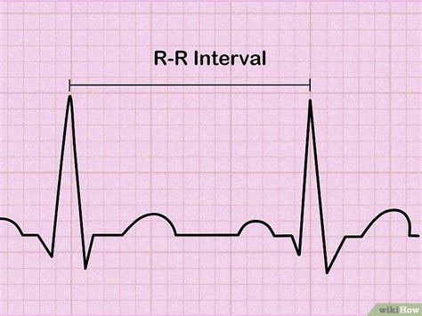 Como Ler Um Eletrocardiograma 9 Passos Com Imagens