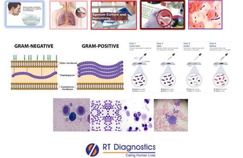 Gramstain Sputum Rt Diagnostics