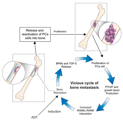 relationship  prostate cancer  bone cancer  ashley smalley blog