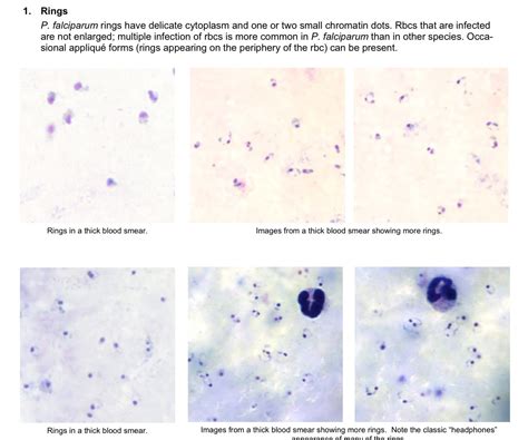 The Life Cycle of Plasmodium Falciparum | Plasmodium Falciparum