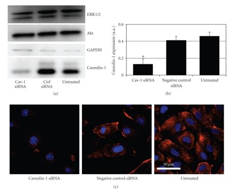 Downregulation of caveolin-1 expression by RNAi. HUVECs were treated ... 