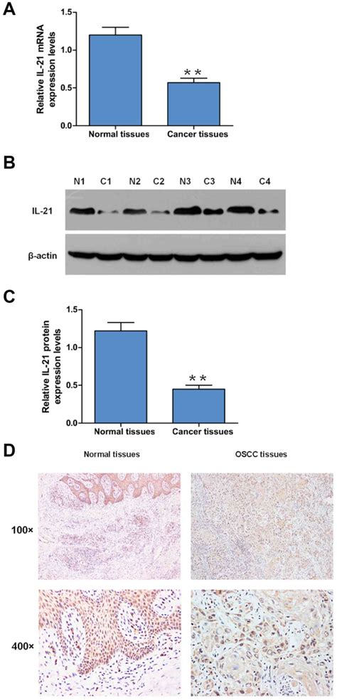 Adenovirusmediated Overexpression Of Interleukin Regulates The