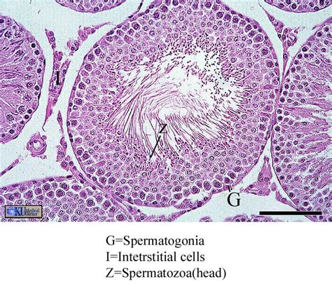 Testis Slide Labeled