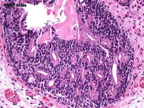 hsp atlas histopathology atlas urinary
