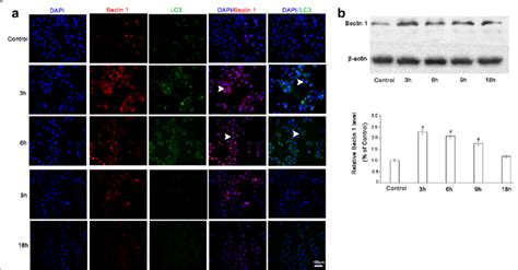 Expression Levels Of Lc Immunofluorescence Assay A And Western