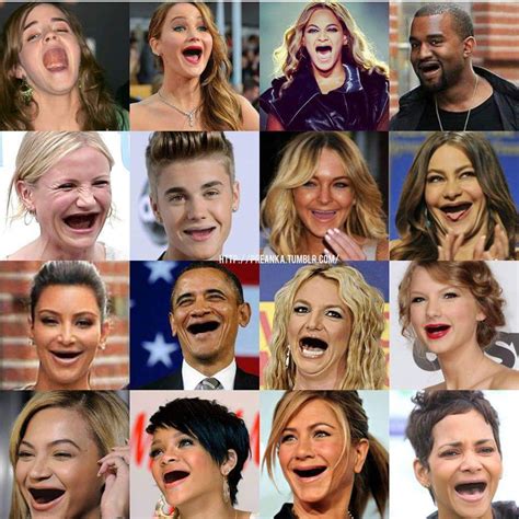 Celebrities without teeth • Stouffville SMILES Dentistry