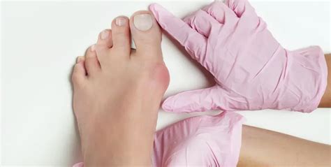 Non Surgical Ways To Alleviate Bunion Pain Board Certified Foot And