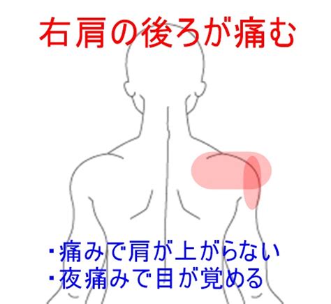 【治療例2】じっとしていても肩が痛む五十肩 治療室そら 藤沢市湘南台の鍼灸院｜ハリ 鍼灸 逆子 肩こり 腰痛