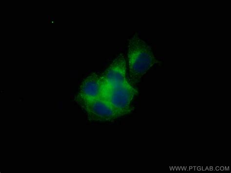 Synaptophysin Antibody 67864 1 Ig Proteintech