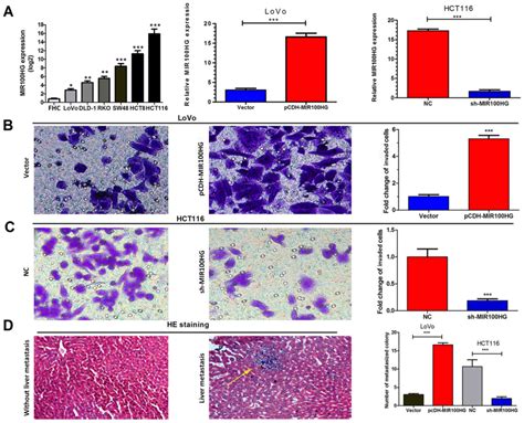 Elevated Mir100hg Promotes Colorectal Cancer Metastasis And Is