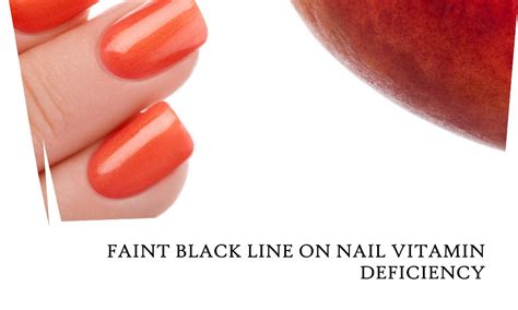 Black Lines On Nails Deficiency At Carl Lee Blog