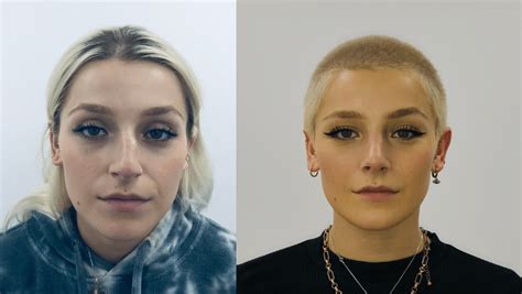 Facial Asymmetry - How to Fix Asymmetrical Face | Centre for Surgery