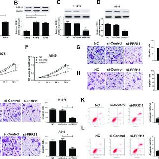 The Effects Of DLX6 AS1 Knockdown On Cell Proliferation Migration