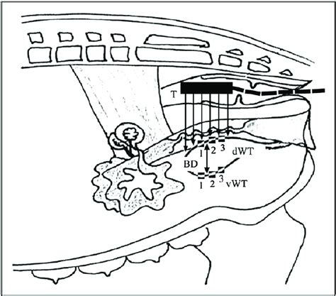 Schematic Illustration Of The Procedure Of Transrectal Ultrasonographic Download Scientific