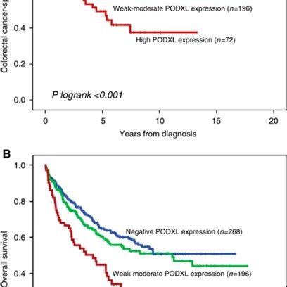 High Expression Of PODXL Is Associated With A Poor Outcome In