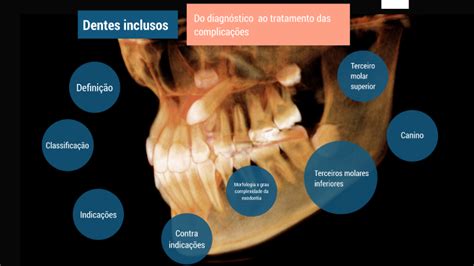 Dentes Inclusos By Luiz Fernando Ara Jo On Prezi