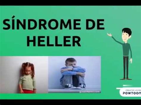 Sindrome De Heller - Síndrome de Heller (Trastorno Desintegrativo Infantil) - YouTube