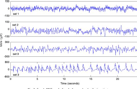 Figure 1 From Automatic Detection Of Epileptic Seizures In EEG Using