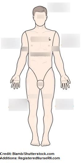 Rule of Nines Diagram | Quizlet