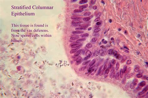 Stratified Columnar Epithelia