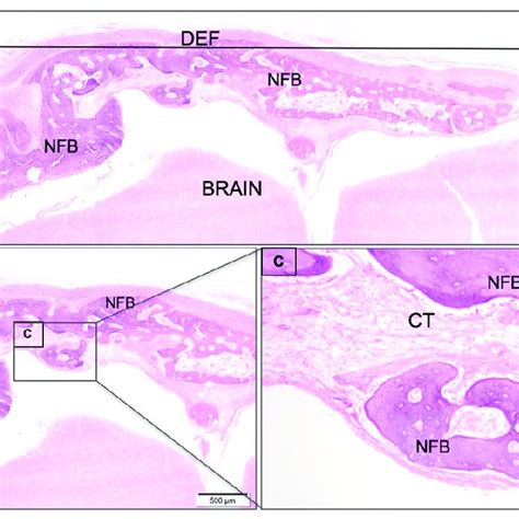 A Histological Sections Of Critical Size Calvaria Defect Of