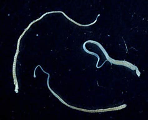 Tapeworms In Human Skin