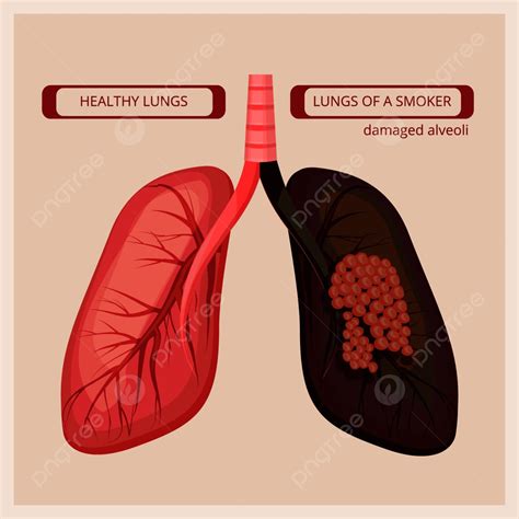 Smoker Lungs Lung Cancer Infographic Poster Template Download On Pngtree