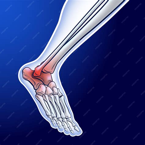 Premium Vector | An illustration of a running ankle bone showing red