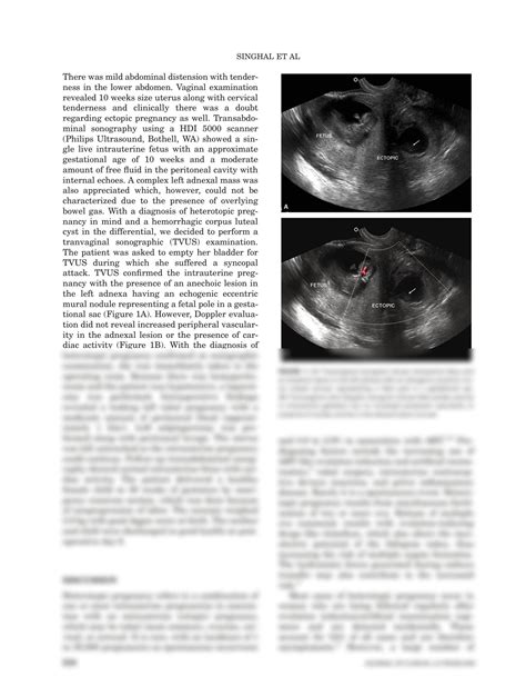 SOLUTION Sonographic Appearance Of Heterotopic Pregnancy With Ruptured