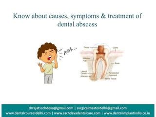 Dental Abscess | PPT