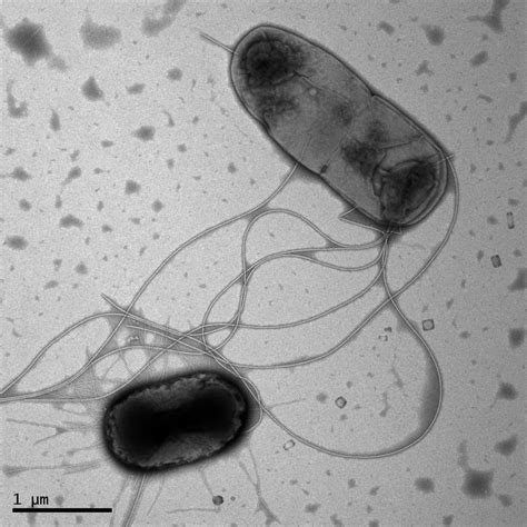 Pandemic E Coli Electr IMAGE EurekAlert Science News Releases