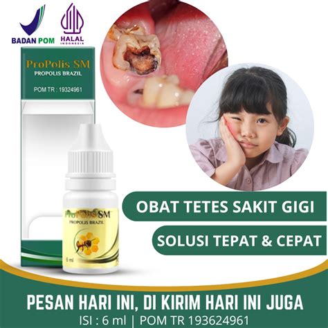 jual obat tetes sakit gigi berlubang anak sakit gigi nyeri gigi anak