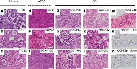 Histopathology Of Oci Xenografts Recapitulate The Original Human