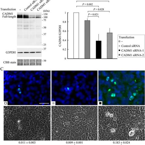 Immunohistochemical Analysis Of Cadm In Iip Lungs Iip Lung Sections