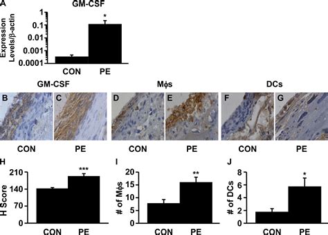 The Implication Of Aberrant Gm Csf Expression In Decidual Cells In The