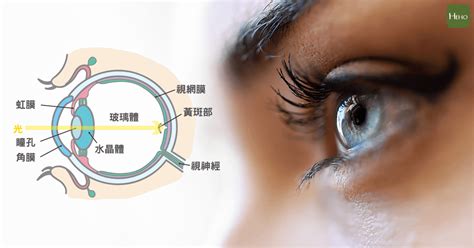 「人工水晶體」在診所換最貴！大愛眼科、藍主仕眼科並列極端價排行榜 Heho健康