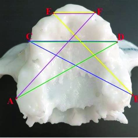 Points For Craniometric Measurements On The Maxillary Alveolar Download Scientific Diagram