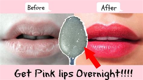 Get Baby Soft Pink Lips In Just 1 Day Naturally At Home Easy 100