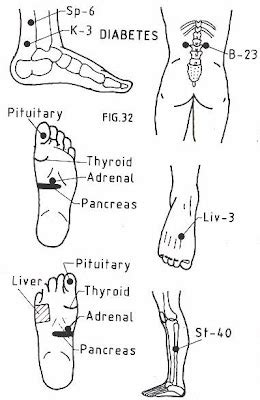 natural therapies in your hand: Acupressure Points- Diabetes