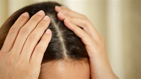 Productos para evitar la caída del pelo de manera efectiva