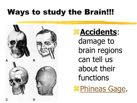 Ways To Study The Brain Accidents Damage To Brain Regions Can Tell