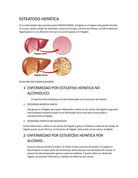 Esteatosis Hepatica Quimica Informe Esteatosis Hepatica Es La