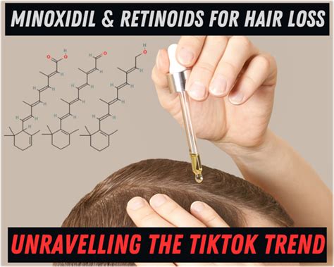 Minoxidil And Retinoic Acid Tretinoin For Hair Loss All You Need To Know