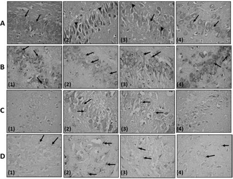 Rows A D A Photomicrograph Of Ca3 Region Of The Hippocampus Row A