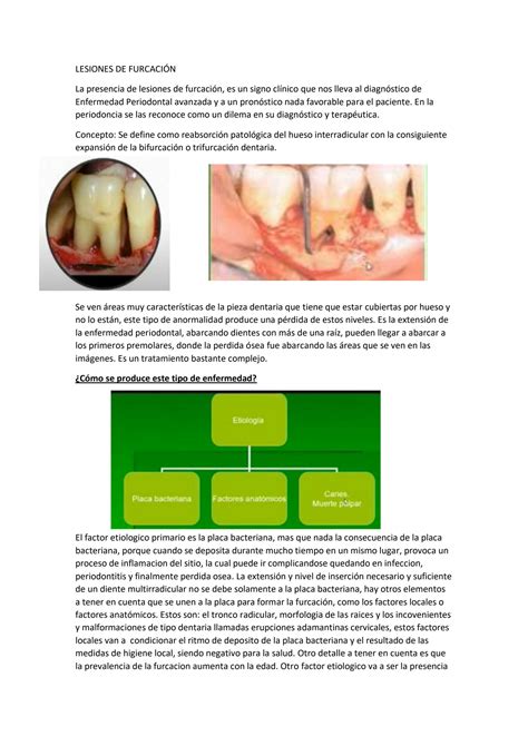 SOLUTION: Lesiones de furcacio n - Studypool