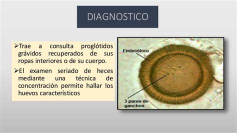 Helmintiasis